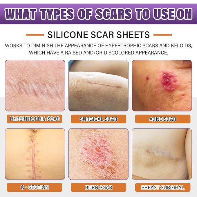 ScarShield Silicon Scar Tape🌟