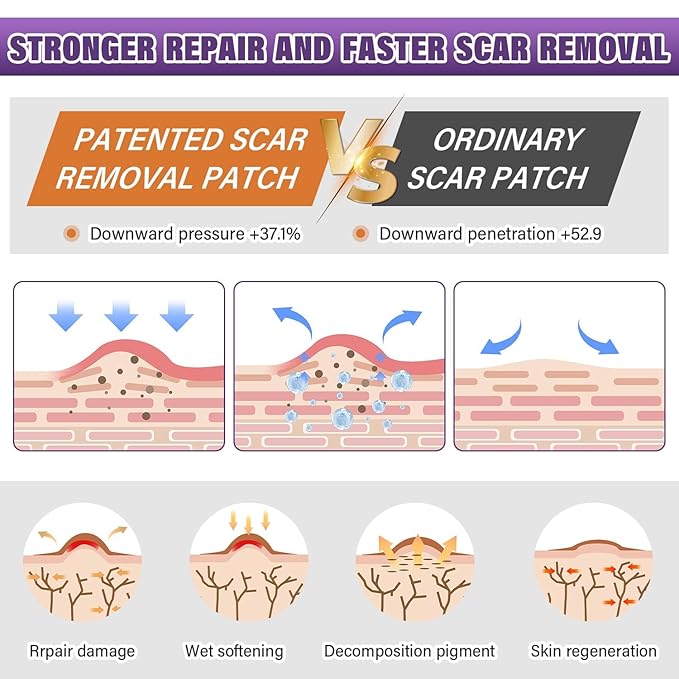 ScarShield Silicon Scar Tape🌟